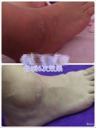 纯中药泡浴药包，