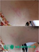 纯中药泡浴药包