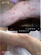 纯中药泡浴药包，