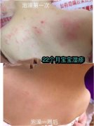 纯中药泡浴药包，