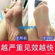 治脚气，鼻炎，狐臭