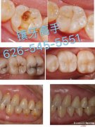 精做假牙：各种烤瓷牙、全瓷牙、美容牙、金属支架、隐形假牙、老